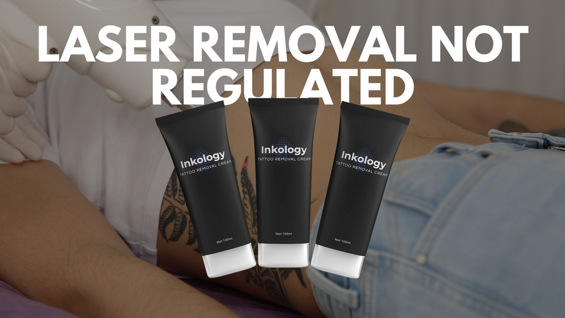 Laser Tattoo Removal Is Not Regulated